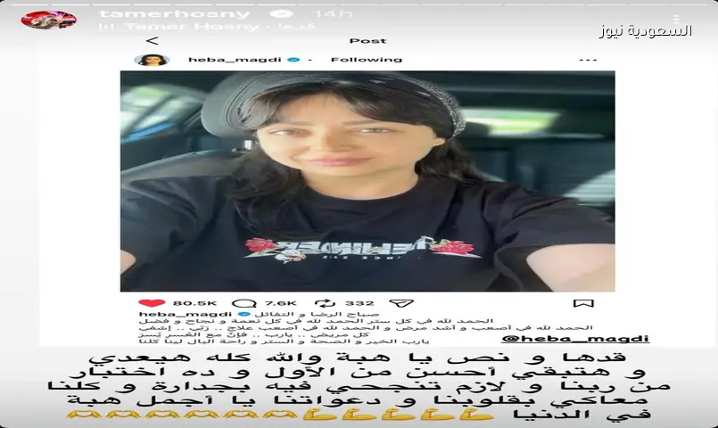 تامر حسني يدعم هبة مجدي بـ ‘قدها ونص’ بعد أزمتها الصحية