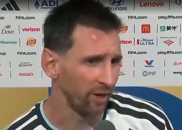 Lionel Messi came away from Argentina's winover Cape Verde with a bruise on his forehead