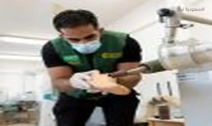 تركيب 21 طرفًا صناعيًا في المجر ضمن مشروع إغاثي سعودي
