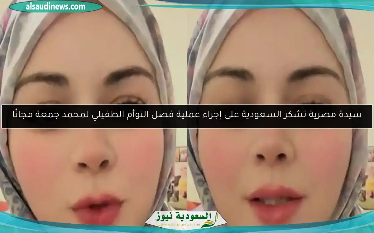 سيدة مصرية تشكر السعودية على إجراء عملية فصل التوأم الطفيلي لمحمد جمعة مجانًا