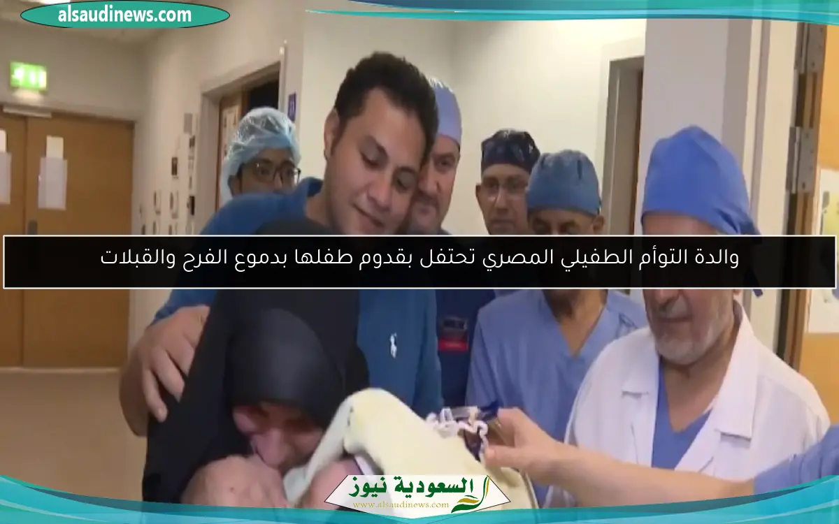 والدة التوأم الطفيلي المصري تحتفل بقدوم طفلها بدموع الفرح والقبلات
