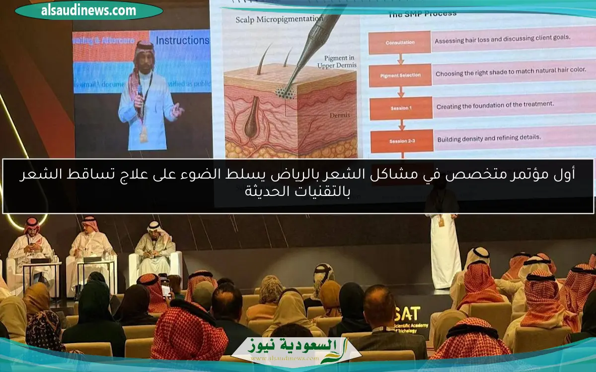 أول مؤتمر متخصص في مشاكل الشعر بالرياض يسلط الضوء على علاج تساقط الشعر بالتقنيات الحديثة