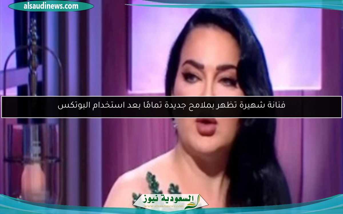 فنانة شهيرة تظهر بملامح جديدة تمامًا بعد استخدام البوتكس