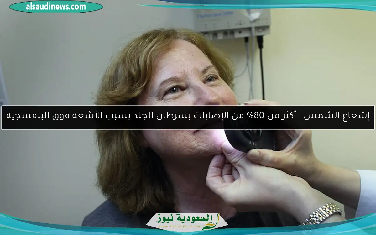 إشعاع الشمس | أكثر من 80% من الإصابات بسرطان الجلد بسبب الأشعة فوق البنفسجية