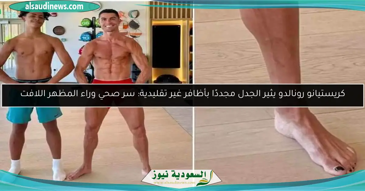 كريستيانو رونالدو يثير الجدل مجددًا بأظافر غير تقليدية: سر صحي وراء المظهر اللافت