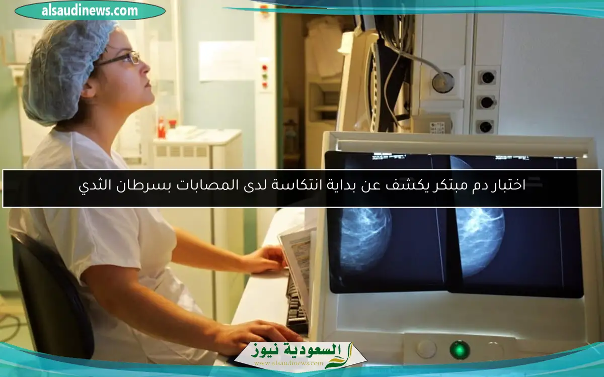 اختبار دم مبتكر يكشف عن بداية انتكاسة لدى المصابات بسرطان الثدي