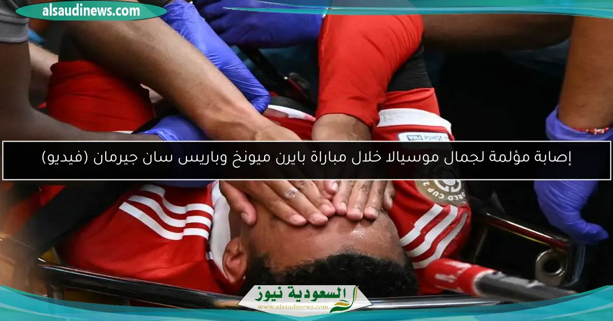 إصابة مؤلمة لجمال موسيالا خلال مباراة بايرن ميونخ وباريس سان جيرمان (فيديو)