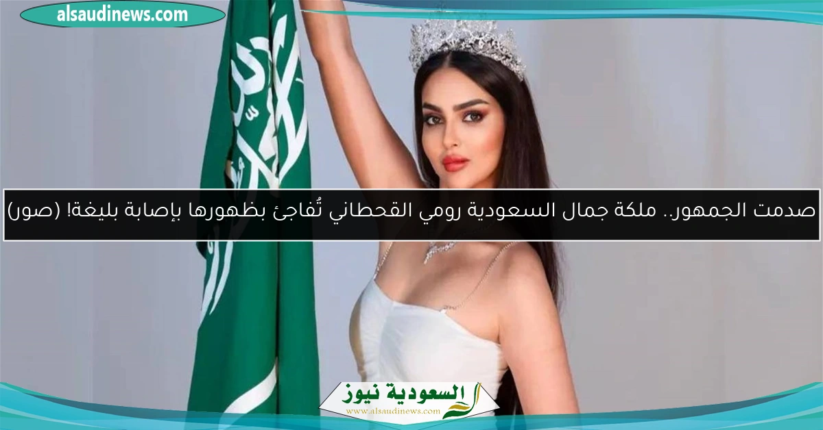 صدمت الجمهور.. ملكة جمال السعودية رومي القحطاني تُفاجئ بظهورها بإصابة بليغة!