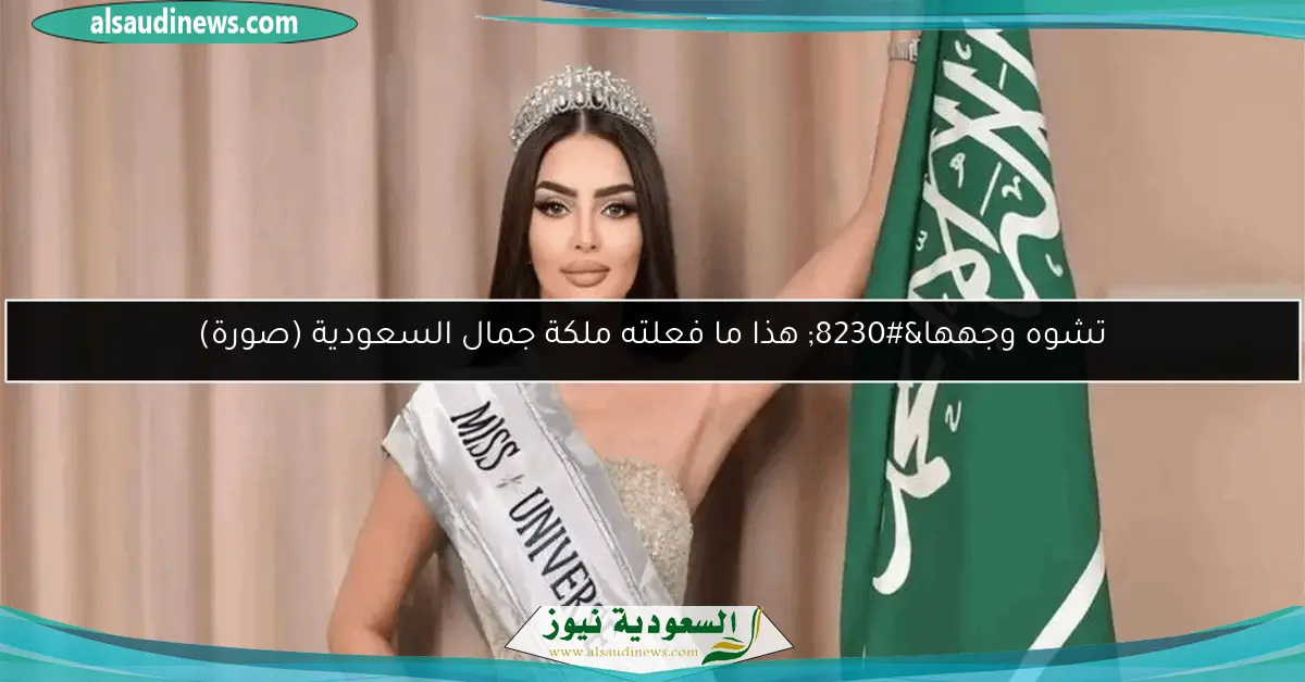 تشوه وجهها… هذا ما فعلته ملكة جمال السعودية (صورة)