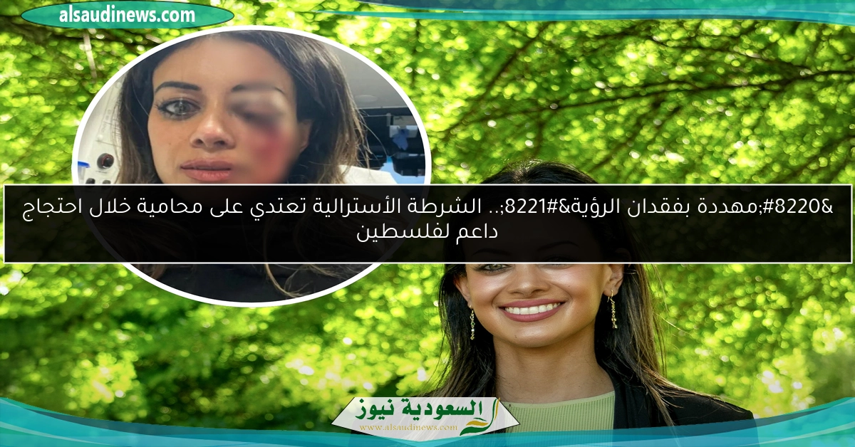 “مهددة بفقدان الرؤية”.. الشرطة الأسترالية تعتدي على محامية خلال احتجاج داعم لفلسطين