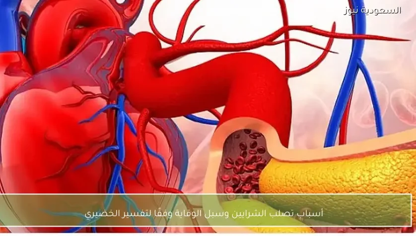 أسباب تصلب الشرايين وسبل الوقاية وفقًا لتفسير الخضيري