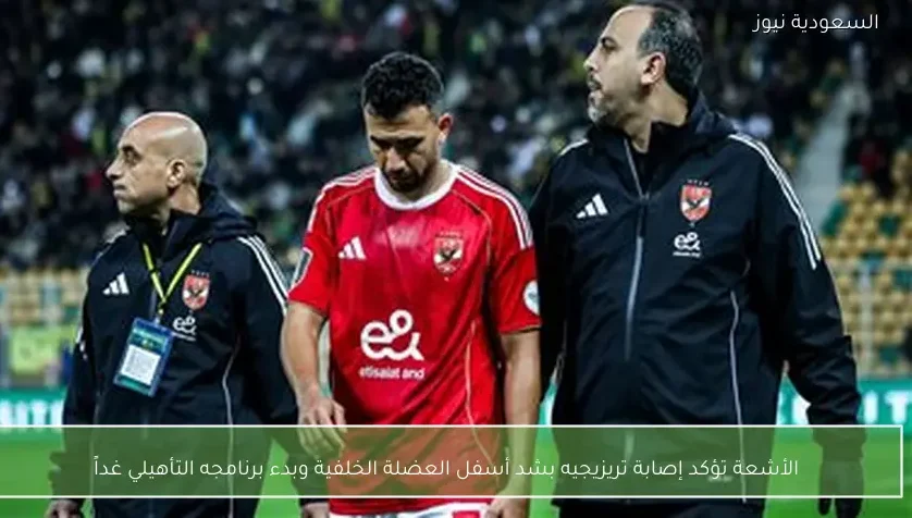 الأشعة تؤكد إصابة تريزيجيه بشد أسفل العضلة الخلفية وبدء برنامجه التأهيلي غداً