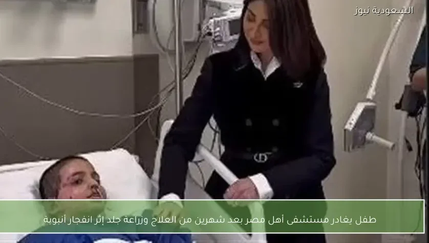 طفل يغادر مستشفى أهل مصر بعد شهرين من العلاج وزراعة جلد إثر انفجار أنبوبة