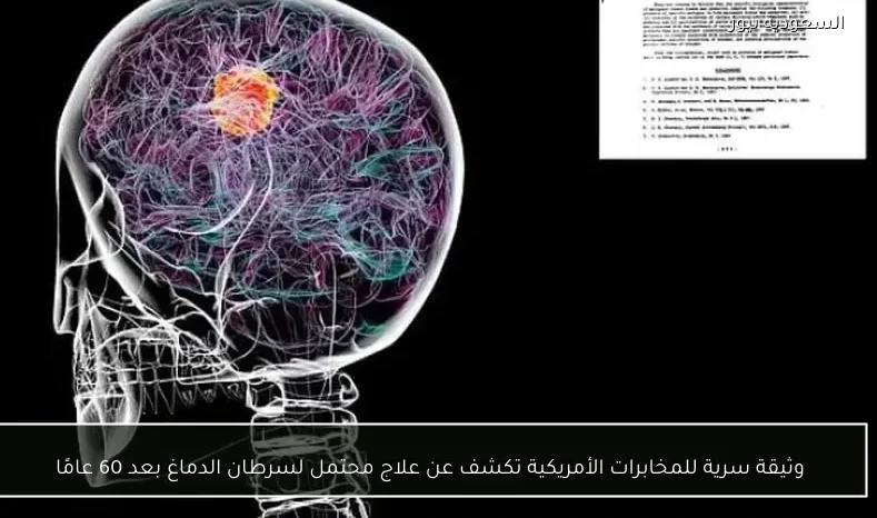 وثيقة سرية للمخابرات الأمريكية تكشف عن علاج محتمل لسرطان الدماغ بعد 60 عامًا